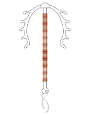 DIU ferradura