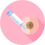 Fibroadenoma de Mama